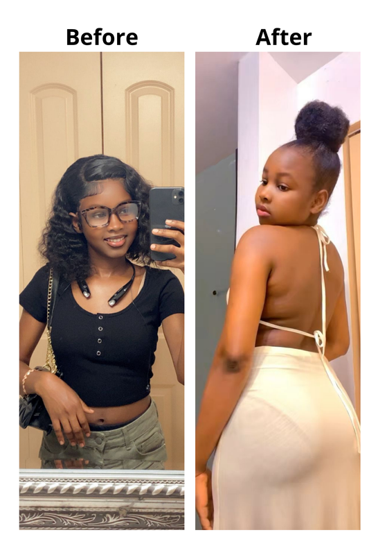 BEFORE AND AFTER